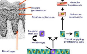 皮膚の幹細胞投与